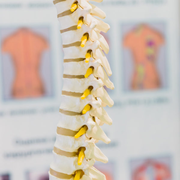 MULTI-LEVEL DISC REPLACEMENT - Texas Spine Care Center